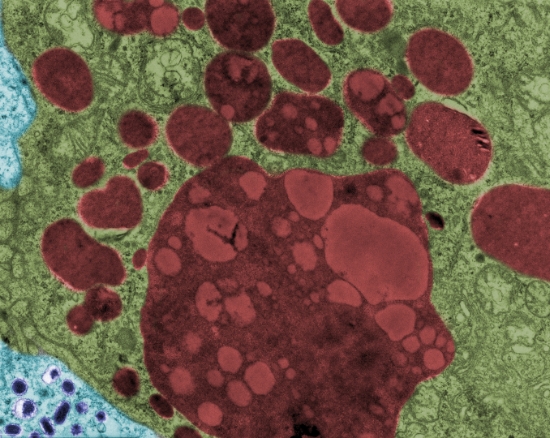 Lysosomal Storage Disorders
